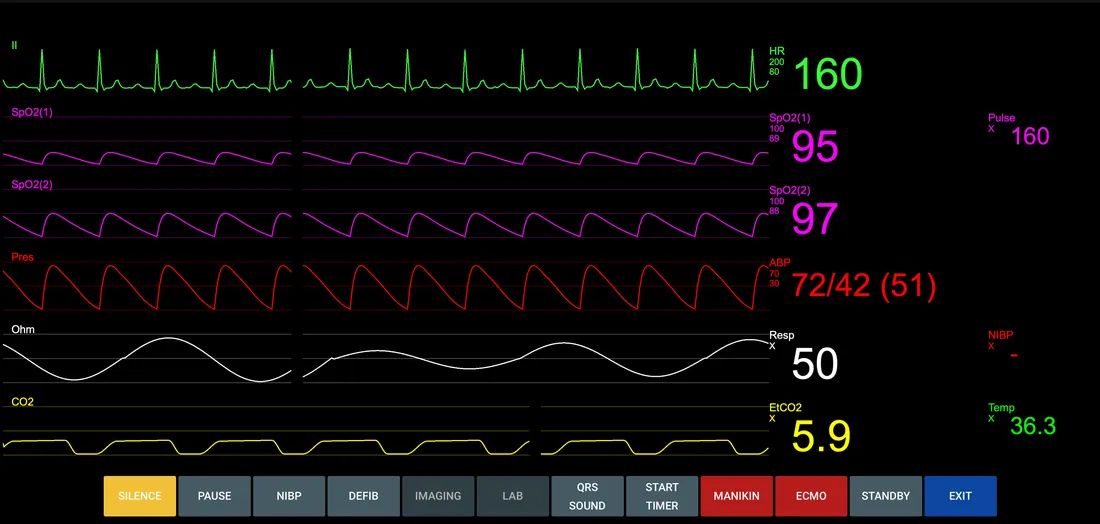 The Explain patient monitor emulator showing ECG, two SpO2 plethysmograms, arterial pressure, respiration and CO2 traces with their numerics.